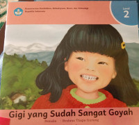 Image of Gigi yang Sudah Sangat Goyah